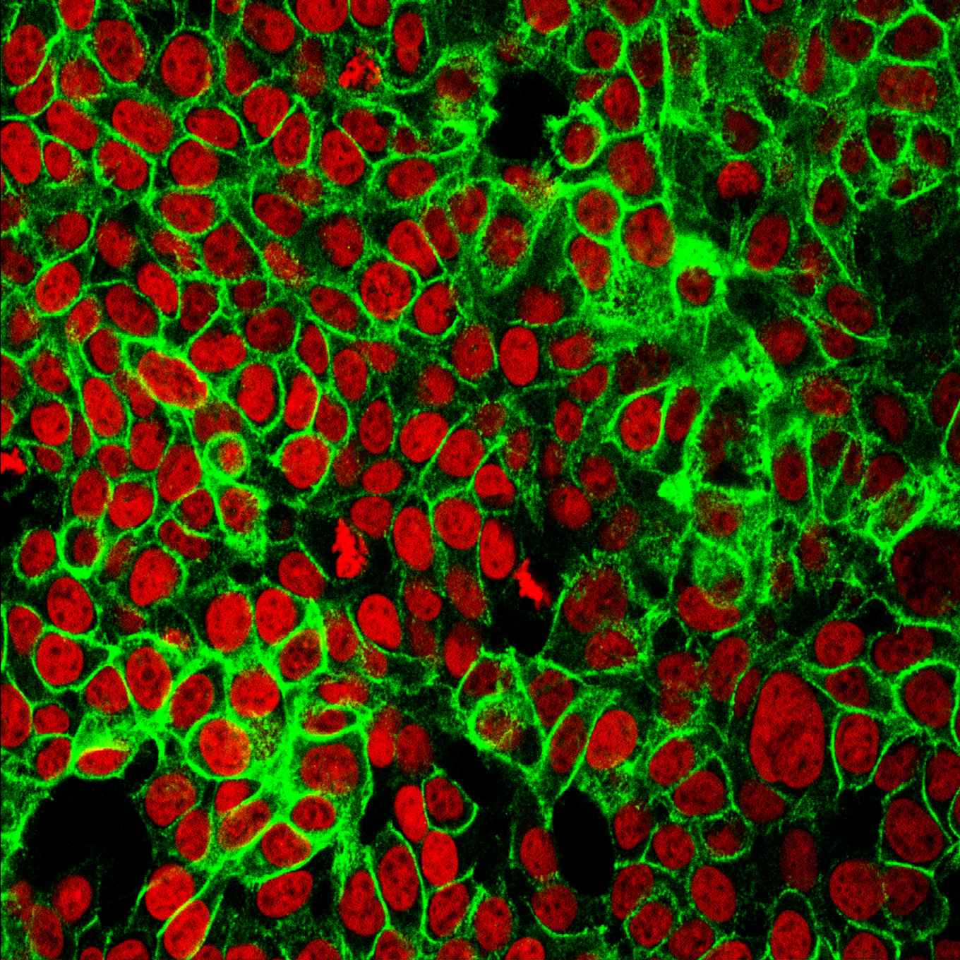 Microscopieafbeelding van ingekleurde kankercellen