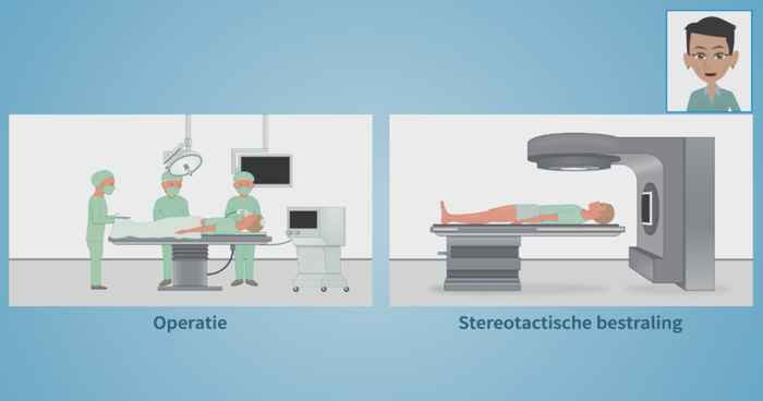 Visuele weergave van hoe een operatie eruitziet en een stereotactische bestraling