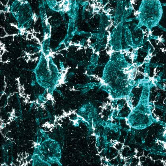 Zenuwcellen (cyaan) omringd door microgliacellen (wit) in de hersenschors (foto: NHI, Viktoir Al-Naqib/Maarten Kole)