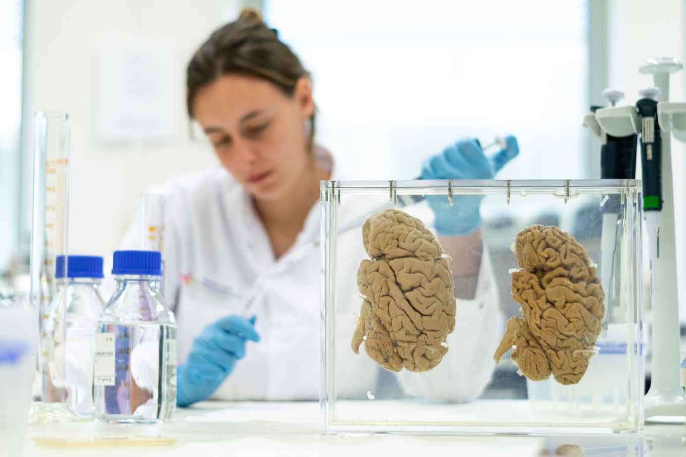 Brain preparation in the lab of the Dutch Brain Bank (photo: Vera van de Donk)